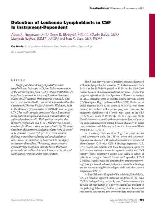 Product Comparision in Detection of Leukemik Lymphoblasts